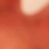 Charming_strawberry